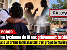Podor : une lycéenne grièvement brûlée après un drame lié à un projet de mariage contesté